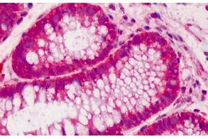 Human Colon: Formalin-Fixed, Paraffin-Embedded (FFPE)