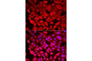 Immunofluorescence analysis of HeLa cell using SRP19 antibody. (SRP19 Antikörper)