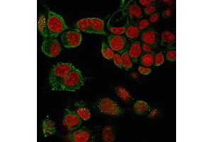 Immunofluorescence staining of paraformaldehyde-fixed HePG2 cells with TNF alpha Mouse Monoclonal Antibody (4C6-H8) followed by goat anti-Mouse IgG-CF488 (Green). (TNF alpha Antikörper  (AA 115-130))