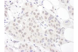 anti-Small Nuclear Ribonucleoprotein D3 Polypeptide 18kDa (SNRPD3) (AA 1-50) antibody