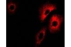 Immunofluorescent analysis of PCCB staining in U2OS cells. (PCCB Antikörper)