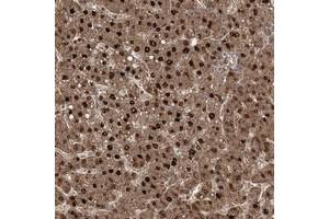 Immunohistochemical staining of human liver with ZBBX polyclonal antibody  shows strong nuclear and cytoplasmic positivity in hepatocytes. (ZBBX Antikörper)