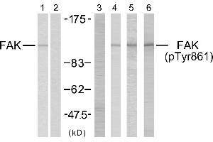 Western blot analysis using FAK (Ab-861) antibody (Line 1 and 2) and FAK (phospho-Tyr861) antibody (Line 3, 4, 5 and 6). (FAK Antikörper  (pTyr861))
