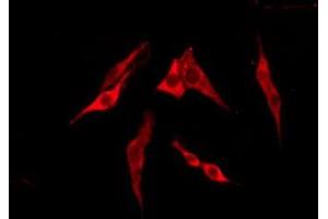 ABIN6276220 staining Hela by IF/ICC. (TAS2R13 Antikörper  (Internal Region))