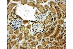 Immunohistochemistry (IHC) image for anti-Membrane Metallo-Endopeptidase (MME) (AA 52-750) antibody (ABIN3043879)