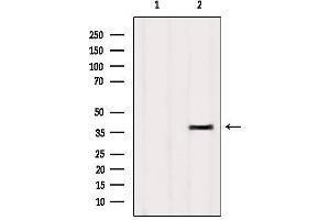 Western blot analysis of extracts from HUVEC, using OR4D9 Antibody. (Olfactory Receptor, Family 4, Subfamily D, Member 9 (OR4D9) Antikörper)