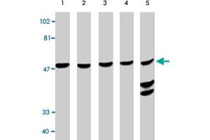 Western blot analysis using CASP10 polyclonal antibody at 0. (Caspase 10 Antikörper  (AA 505-521))