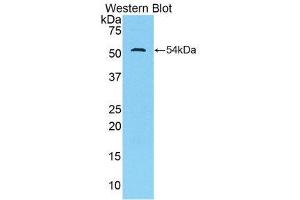 Western Blotting (WB) image for anti-Trefoil Factor 3 (Intestinal) (TFF3) (AA 23-81) antibody (ABIN1860708)