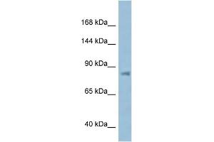 WB Suggested Anti-KPNB1 AntibodyTitration: 1. (KPNB1 Antikörper  (N-Term))