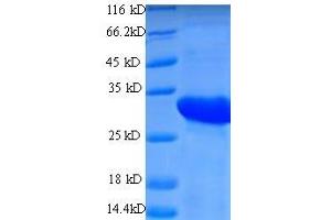 CD74 Antigen (Invariant Polypeptide of Major Histocompatibility Complex, Class II Antigen-Associated) (CD74) (AA 57-280) protein (His tag) expressed in E. (CD74 Protein (AA 57-280) (His tag))