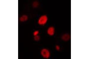 ABIN6274428 staining HuvEc cells by IF/ICC. (HIPK4 Antikörper  (C-Term))