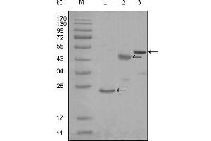 Western blot analysis using KARS mouse mAb against truncated Trx-KARS recombinant protein (1), truncated MBP-KARS (aa90-174) and full length KARS (aa1-188) transfected CHO-K1 cell lysate (3). (KARS Antikörper)