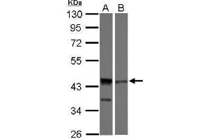 WB Image Sample (30 ug of whole cell lysate) A: 293T B: Jurkat 10% SDS PAGE antibody diluted at 1:1000 (DFFA Antikörper)