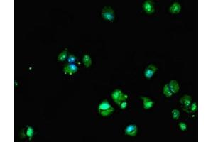 Immunofluorescent analysis of MCF-7 cells using ABIN7149610 at dilution of 1:100 and Alexa Fluor 488-congugated AffiniPure Goat Anti-Rabbit IgG(H+L) (DHRS12 Antikörper  (AA 1-271))