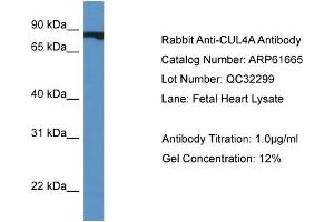 Western Blotting (WB) image for anti-Cullin 4A (CUL4A) (Middle Region) antibody (ABIN2788865) (Cullin 4A Antikörper  (Middle Region))