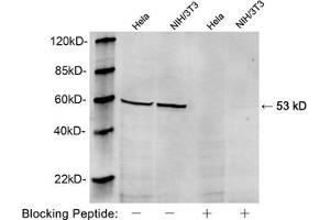 Western blot analysis of Hela and NIH/3T3 cell lysates using 1 µg/mL Rabbit Anti-Vimentin Polyclonal Antibody (ABIN398717) The signal was developed with IRDyeTM 800 Conjugated Goat Anti-Rabbit IgG (Vimentin Antikörper  (AA 70-120))