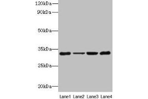 Western blot All lanes: PDCD1 antibody at 6 μg/mL Lane 1: 293T whole cell lysate Lane 2: Hela whole cell lysate Lane 3: K562 whole cell lysate Lane 4: Mouse stomach tissue Secondary Goat polyclonal to rabbit IgG at 1/10000 dilution Predicted band size: 32 kDa Observed band size: 32 kDa (PD-1 Antikörper  (AA 21-170))
