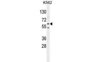 PRKAA2 (Thr172) Antibody western blot analysis in K562 cell line lysates (35µg/lane). (PRKAA2 Antikörper  (Middle Region, Thr172))