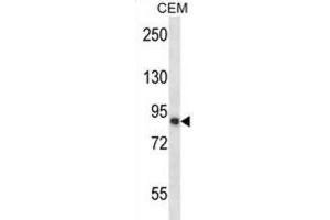 Western Blotting (WB) image for anti-Calpain 11 (CAPN11) antibody (ABIN2997590) (CAPN11 Antikörper)