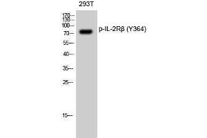 Western Blotting (WB) image for anti-Interleukin 2 Receptor, beta (IL2RB) (pTyr364) antibody (ABIN3173048) (IL2 Receptor beta Antikörper  (pTyr364))