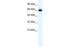 WB Suggested Anti-KCNH5 Antibody Titration:  0. (KCNH5 Antikörper  (N-Term))