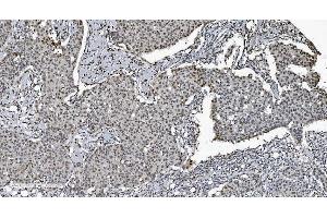IHC analysis of SAMHD1 using anti-SAMHD1 antibody (ABIN7601514). (SAMHD1 Antikörper  (AA 37-626))