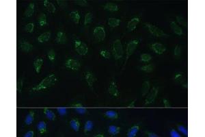 Immunofluorescence analysis of U-2 OS cells using HIGD1A Polyclonal Antibody at dilution of 1:100 (40x lens). (HIGD1A Antikörper)