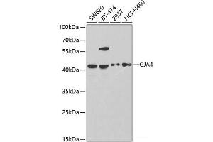 Western blot analysis of extracts of various cell lines using GJA4 Polyclonal Antibody at dilution of 1:1000. (GJA4 Antikörper)