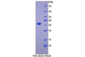 SDS-PAGE (SDS) image for Hemoglobin beta (HBB) (AA 1-147) protein (His tag) (ABIN1170612) (Hemoglobin Subunit beta Protein (AA 1-147) (His tag))