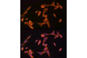 Immunofluorescence analysis of NIH/3T3 cells using NOD2 Rabbit pAb (ABIN7269065) at dilution of 1:150 (40x lens).