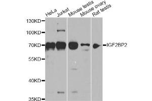 Western blot analysis of extracts of various cell lines, using IGF2BP2 antibody (ABIN6293018) at 1:1000 dilution. (IGF2BP2 Antikörper)