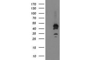 HEK293T cells were transfected with the pCMV6-ENTRY control (Left lane) or pCMV6-ENTRY ASCC1 (Right lane) cDNA for 48 hrs and lysed. (ASCC1 Antikörper)