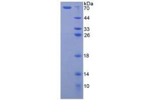 Image no. 1 for Arginase, Type II (ARG2) (AA 23-354) protein (His tag,GST tag) (ABIN1981148) (ARG2 Protein (AA 23-354) (His tag,GST tag))