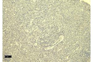 Immunohistochemistry (IHC) image for anti-Ionized Calcium-binding Adapter Molecule 1 (IBA1) (C-Term) antibody (ABIN184738)