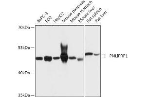 Western blot analysis of extracts of various cell lines, using PNLIPRP1 antibody (ABIN7269167) at 1:1000 dilution. (PNLIPRP1 Antikörper  (AA 298-467))