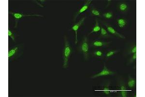 Immunofluorescence of purified MaxPab antibody to TUBG1 on HeLa cell.