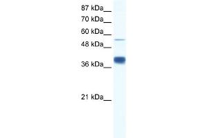 WB Suggested Anti-DKFZP781I1119 Antibody Titration:  0. (DKFZP781I1119 (N-Term) Antikörper)
