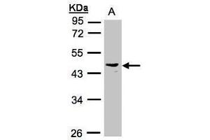 WB Image Sample(30 ug whole cell lysate) A:Raji , 10% SDS PAGE antibody diluted at 1:1000 (PSG6 Antikörper)