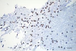 Immunohistochemistry was performed on paraffin-embedded mouse brain using XPD antibody (ABIN7798540), 1:200). (Rekombinanter ERCC2 Antikörper)