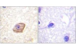 Immunohistochemistry analysis of paraffin-embedded human brain, using NMDAR2B (Phospho-Tyr1474) Antibody. (GRIN2B Antikörper  (pTyr1474))