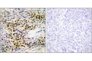 Immunohistochemistry analysis of paraffin-embedded human ovary tissue, using Akt (Ab-246) Antibody. (AKT1 Antikörper  (AA 212-261))
