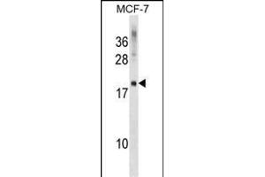CMTM5 Antibody (Center) (ABIN1538533 and ABIN2849118) western blot analysis in MCF-7 cell line lysates (35 μg/lane). (CMTM5 Antikörper  (AA 62-88))