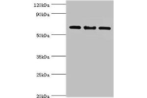 Western blot All lanes: IL22RA1 antibody at 10 μg/mL Lane 1: Mouse spleen tissue Lane 2: HepG2 whole cell lysate Lane 3: 293T whole cell lysate Secondary Goat polyclonal to rabbit IgG at 1/10000 dilution Predicted band size: 63 kDa Observed band size: 63 kDa (IL22 Receptor alpha 1 Antikörper  (AA 16-230))