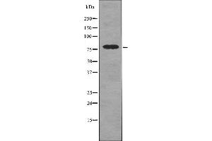 Western blot analysis DRP1 (pS616) using UV treated 293 whole cell lysates. (Dynamin 1-Like Antikörper  (pSer616))