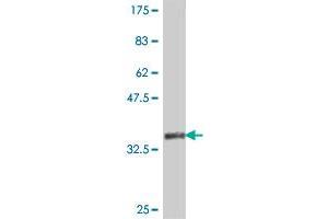 Western Blot detection against Immunogen (37. (ITPR1 Antikörper  (AA 2470-2577))