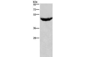 Western Blot analysis of Human serum solution using IL8RB Polyclonal Antibody at dilution of 1:125 (CXCR2 Antikörper)