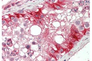 Rabbit Anti-KLHL25 antibody  Formalin Fixed Paraffin Embedded Tissue: Human Testis Primary antibody Concentration: 1:100 Secondary Antibody: Donkey anti-Rabbit-Cy3 Secondary Antibody Concentration: 1:200 Magnification: 20x Exposure Time: 0. (KLHL25 Antikörper  (N-Term))