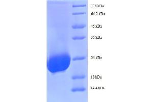 Adiponectin, C1Q and Collagen Domain Containing (ADIPOQ) (AA 19-244) protein (His tag) expressed in yeast
