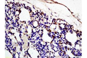 Formalin-fixed and paraffin embedded rat lung labeled with Rabbit Anti-Complement fragment 3c Polyclonal Antibody (ABIN873279) at 1:200 followed by conjugation to the secondary antibody and DAB staining (Complement C3c Antikörper  (AA 1051-1200))