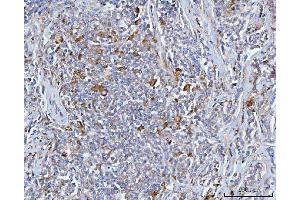 IHC analysis of BCAT1 using anti-BCAT1 antibody (ABIN7602594).